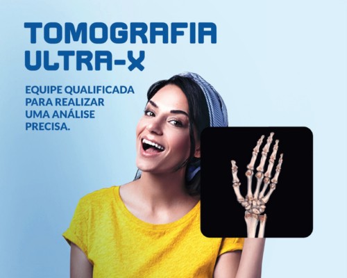 Campanha para o Ultra-X traz imagens reais de exames de tomografia
